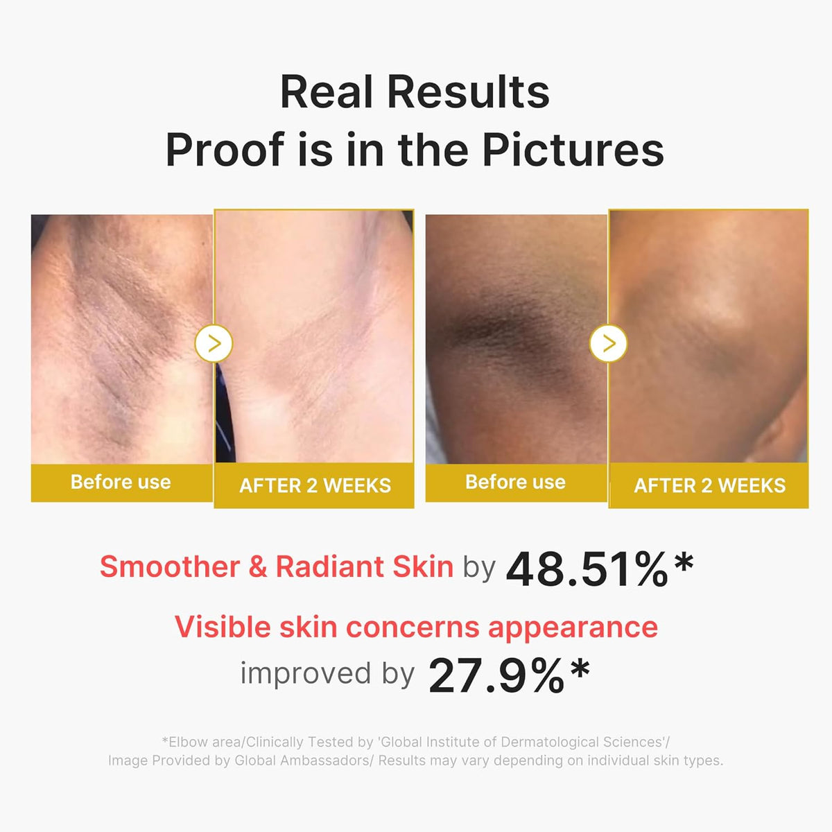 medicube Body Peel Shot with Kojic Acid and Turmeric