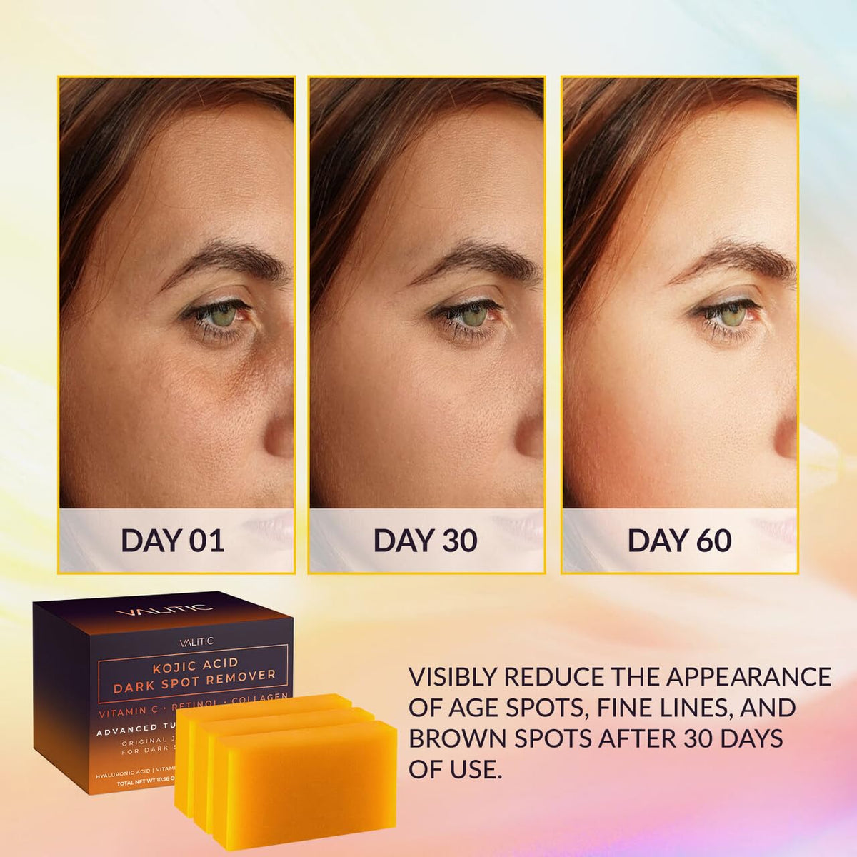 VALITIC Kojic Acid Dark Spot Remover Soap Bars, Turmeric Bar Soaps 3 Pack