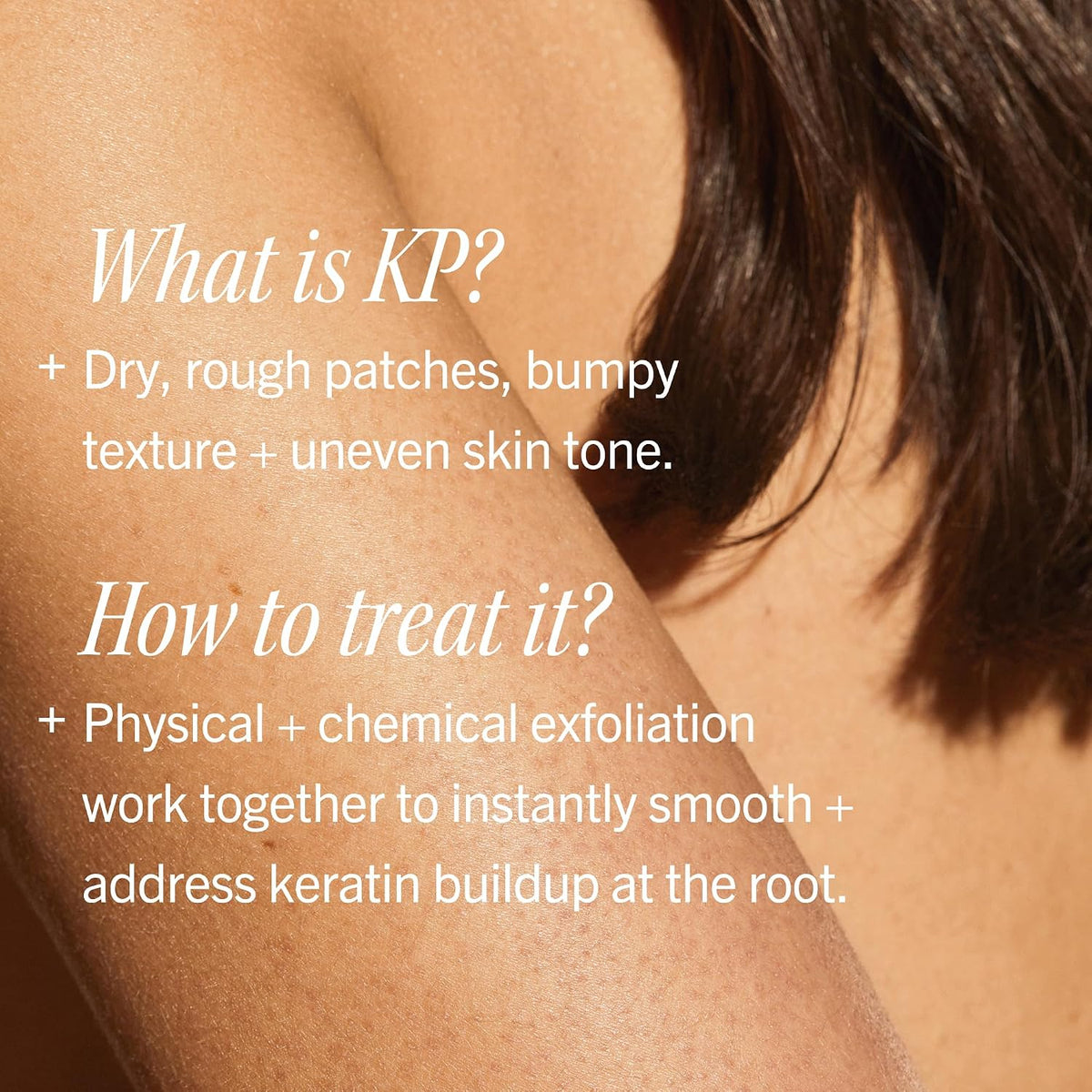 First Aid Beauty KP Bump Eraser Scrub, 10% AHA, Sensitive Skin